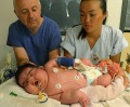 Mulher dá à luz bebê de 6,1 kg - Fotos