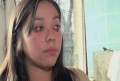 Bizarro: Chilena que chora sangue - Fotos-1